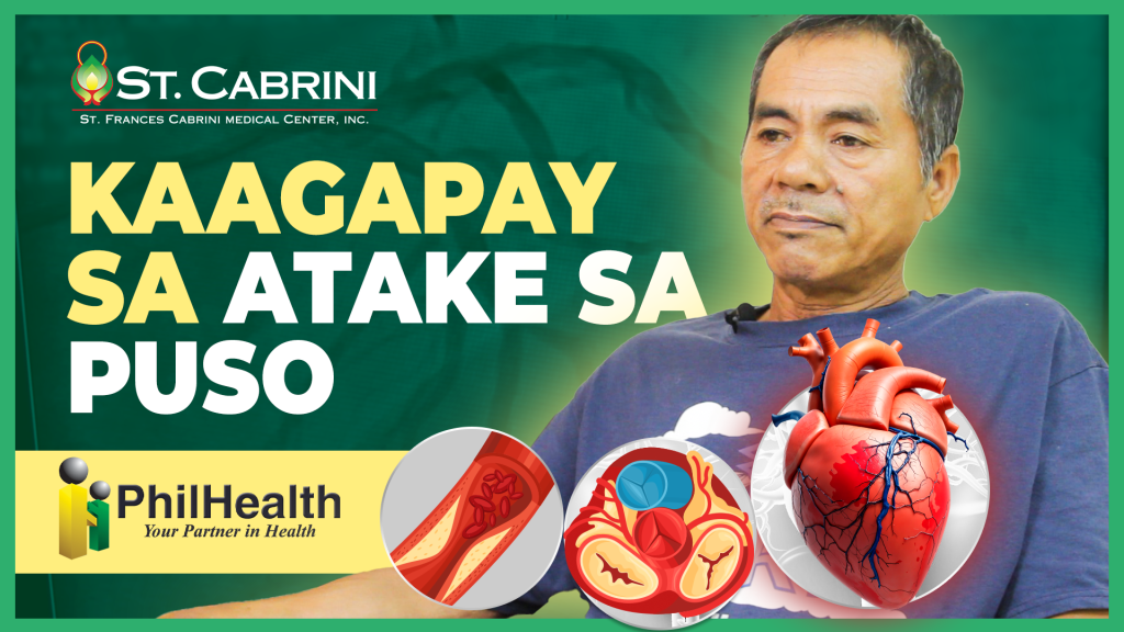 Kaagay sa Atake sa Puso